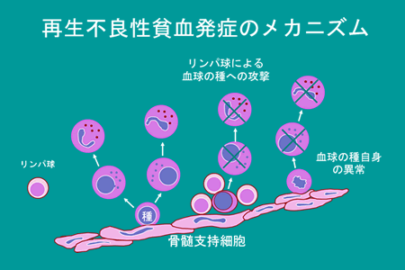貧血.gif